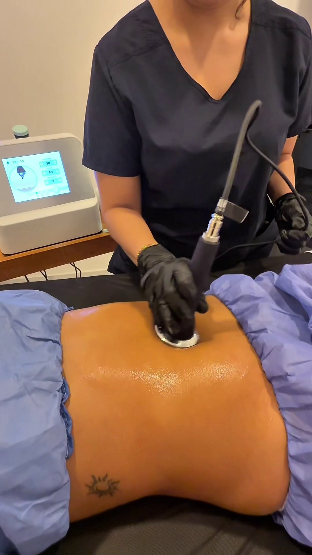 Ultrasonido Grado Médico en Zapopan – Très Belle Derma Clinique, cerca del Tec de Monterrey