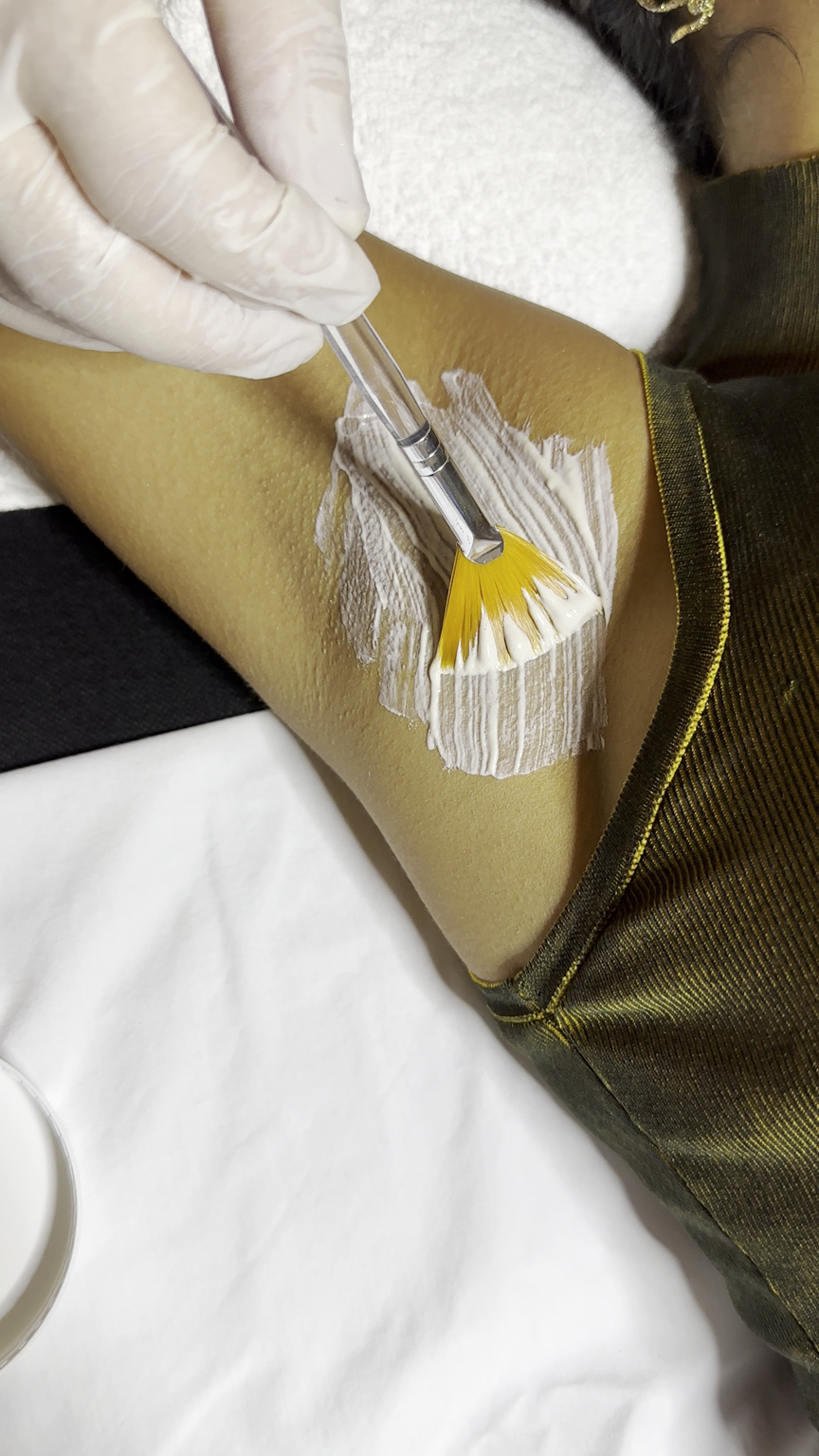 Facial Despigmentante en Zapopan – Très Belle Derma Clinique, cerca del Tec de Monterrey