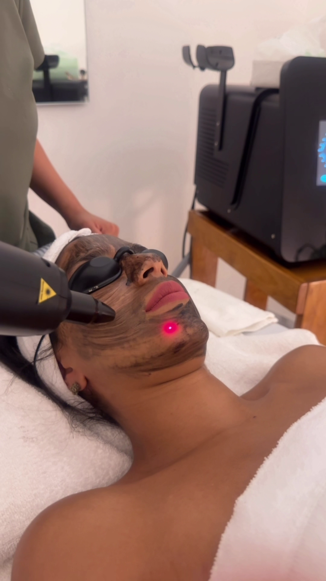 Hollywood Peel en Zapopan – Très Belle Derma Clinique, cerca del Tec de Monterrey