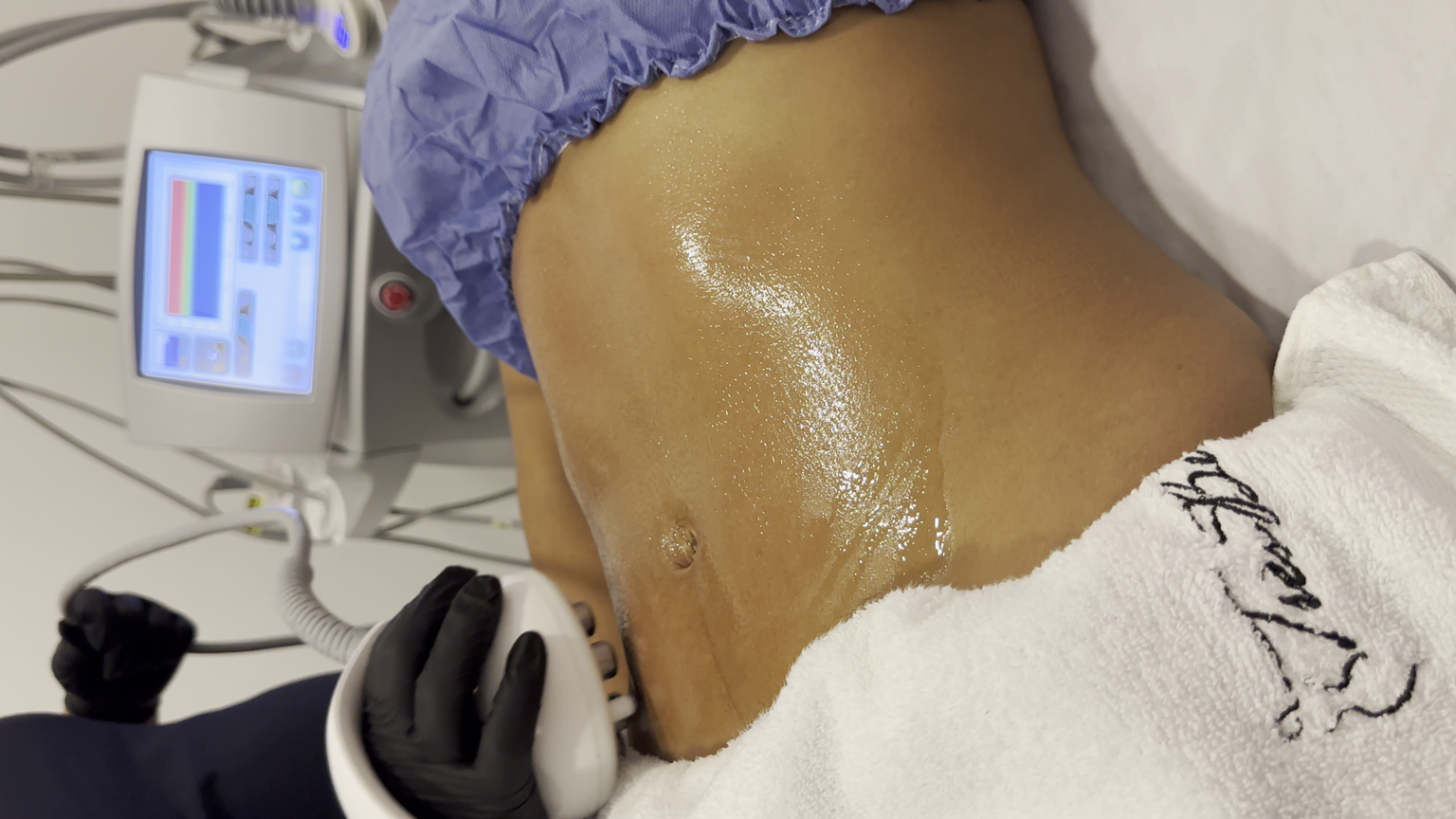 Venus Legacy Corporal en Zapopan – Très Belle Derma Clinique, cerca del Tec de Monterrey