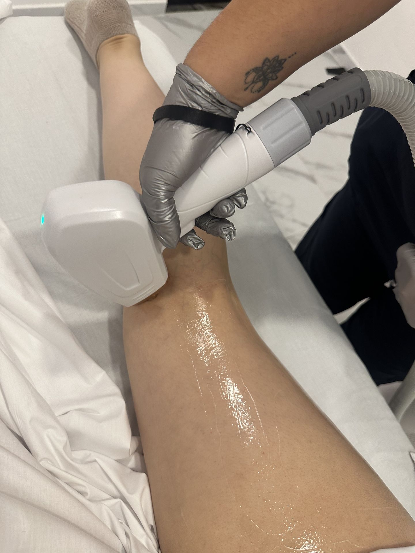 Depilación Láser Tridiodo en Zapopan – Très Belle Derma Clinique, cerca del Tec de Monterrey